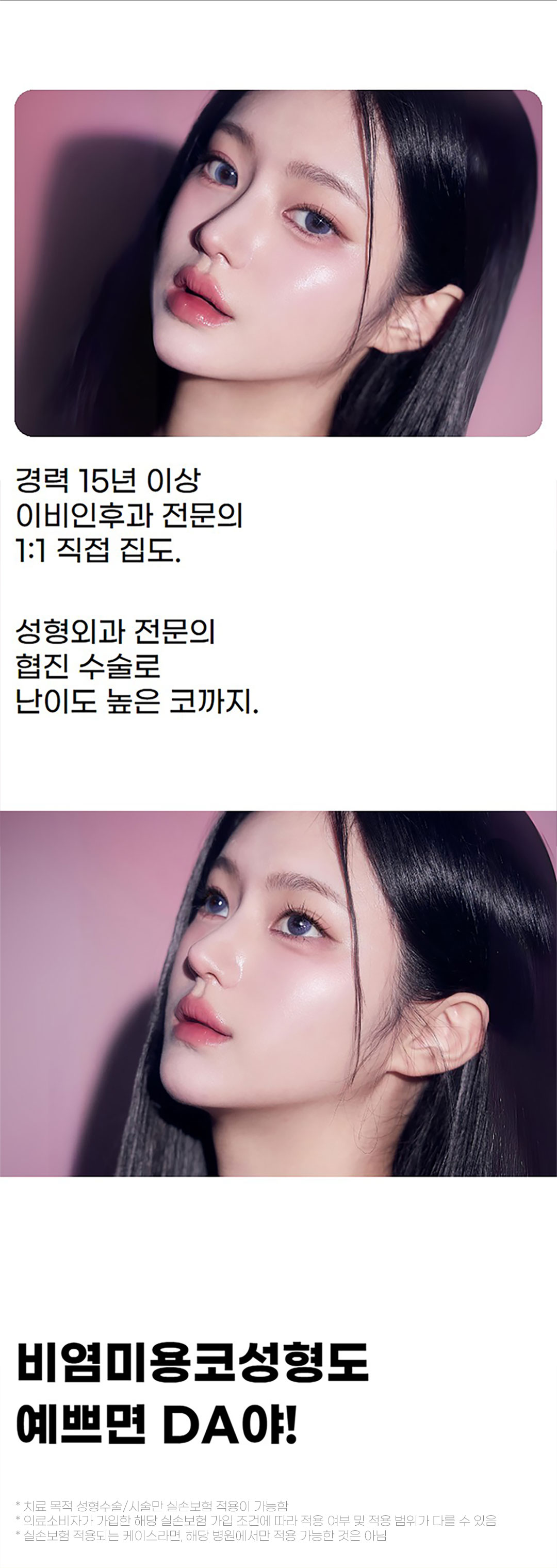 코끝부터 콧대까지 개선하는 비염코성형