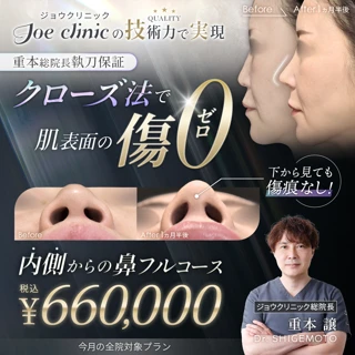 クローズ法｜鼻フルコース