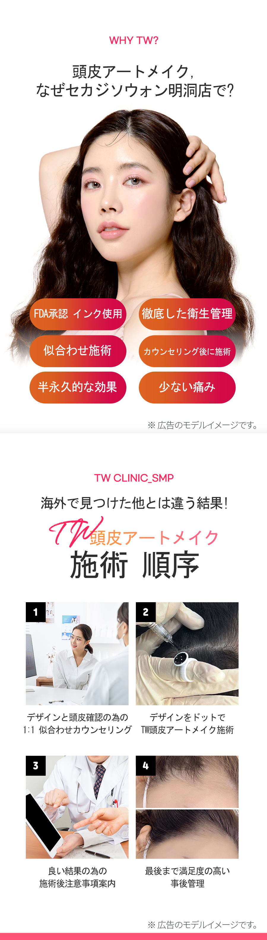 TW頭皮アートメイク人気占 | セカジソウォン医院 明洞院
