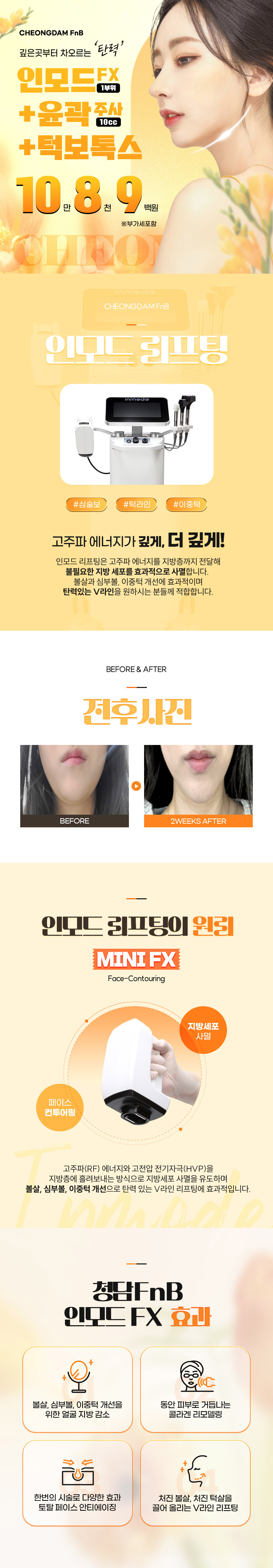 인모드FX로 지방세포를 줄이고, 윤곽주사로 지방전체를 분해하고 턱보톡스로 턱 라인에 있는 근육을 잡아줌으로써
전체적인 페이스 라인을 개선해 볼 수 있습니다.