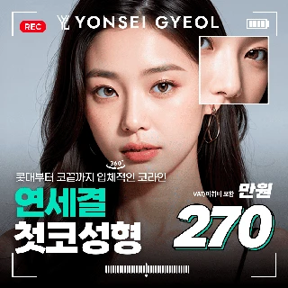 대표원장 직접수술 첫코성형 - 콧대 & 코끝성형