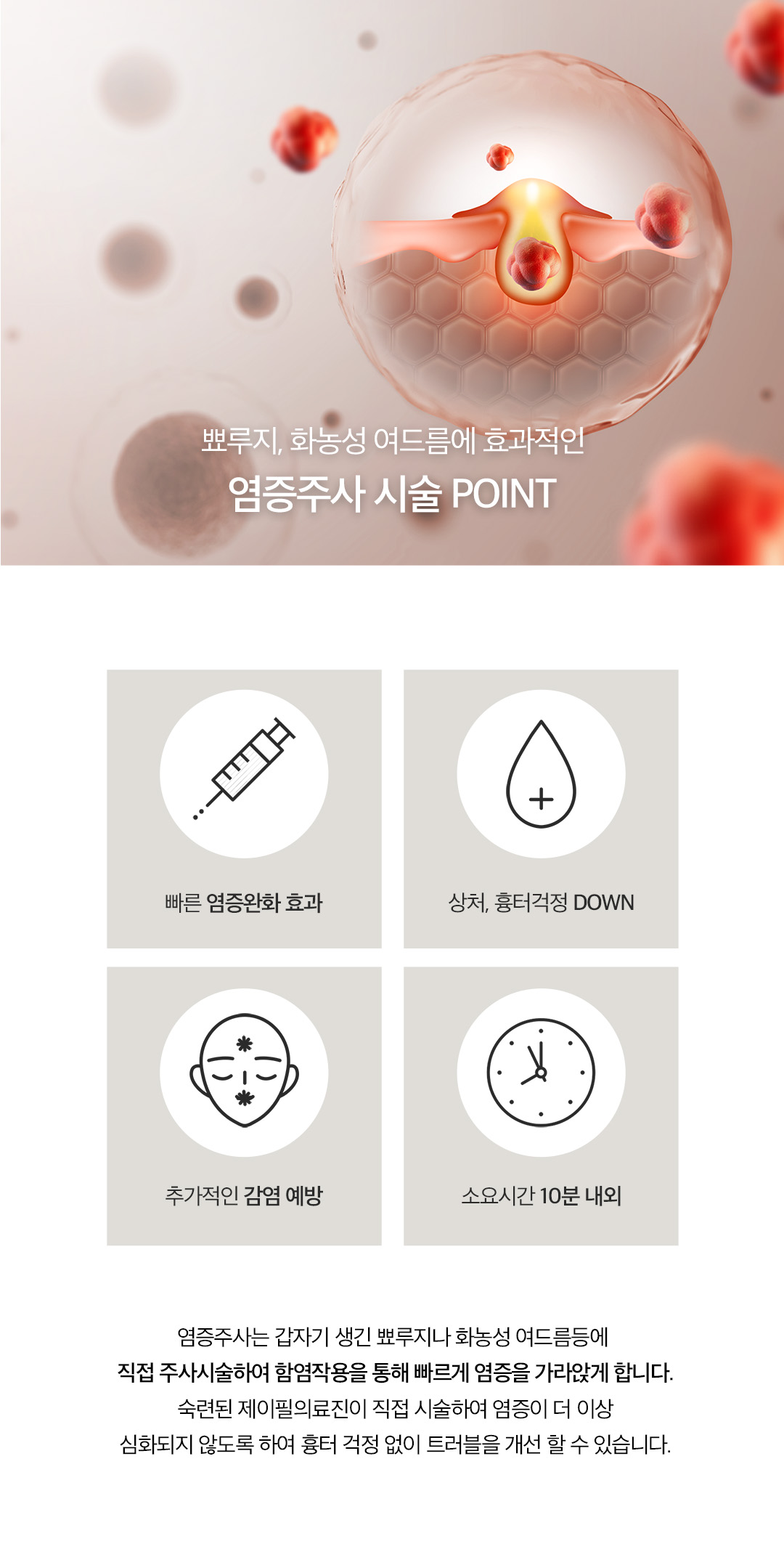 제이필 염증주사로 갑자기 생긴 트러블, 여드름 미리 관리하기
손으로 만지면 피부에 상처가 생겨서 색소침착과 흉터가 생길 수 있어서 염증 주사가 필요
- 갑자기 생긴뾰루지나 화농성 여드름에 직접 주사하여 항염작용을 통해 빠르게 염증 가라앉힘
- 추가 감염 예방 및 상처 흉터 걱정 DOWN