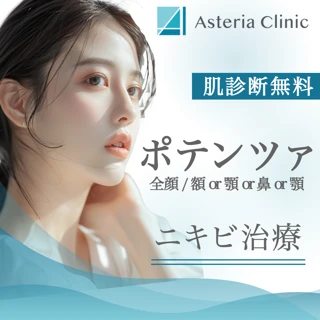 ポテンツァ:ニキビ治療:一部位:額or顎or鼻:初回(トライアル)/VISIAの肌診断無料・ピュレアジーの成長因子マスク+化粧水乳液付き