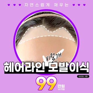 회복빠른_비절개 헤어라인모발이식_머리모발이식