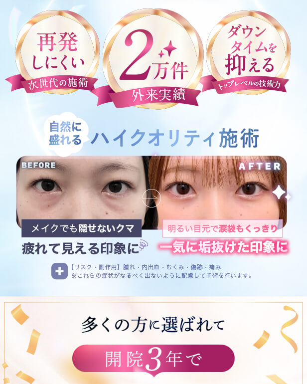【利用条件・モニターについて】
・SNSやHP等に全顔の掲載が可能な方
・施術前後に一定回数クリニックに通院し、ビフォー/アフターの撮影が可能な方
※非モニターの場合、通常価格でのご案内となります。
【当日施術について】
当日の施術室の空き枠次第でご案内可能です。
【アフターケアについて】
ダウンタイムの過ごし方や注意事項などの詳細は、カウンセリング時にしっかりとお伝えさせていただきます。
当院は、術後のアフターケアに力を入れております。
ダウンタイム中に感じた不安点やトラブルなどは、すぐに対応いたします。
安心して受診・施術できるようスタッフが一丸となってサポートさせていただきますのでお気軽にご相談下さいませ。