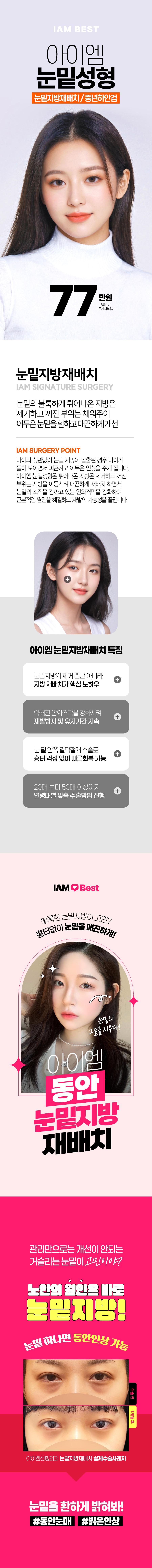 불룩한 눈밑지방과  다크써클 개선,  눈밑꺼짐을 개인과 연령대에 맞게 눈밑지방재배치 또는 중년하안검 수술을 통해 눈밑을 환하게 밝히다