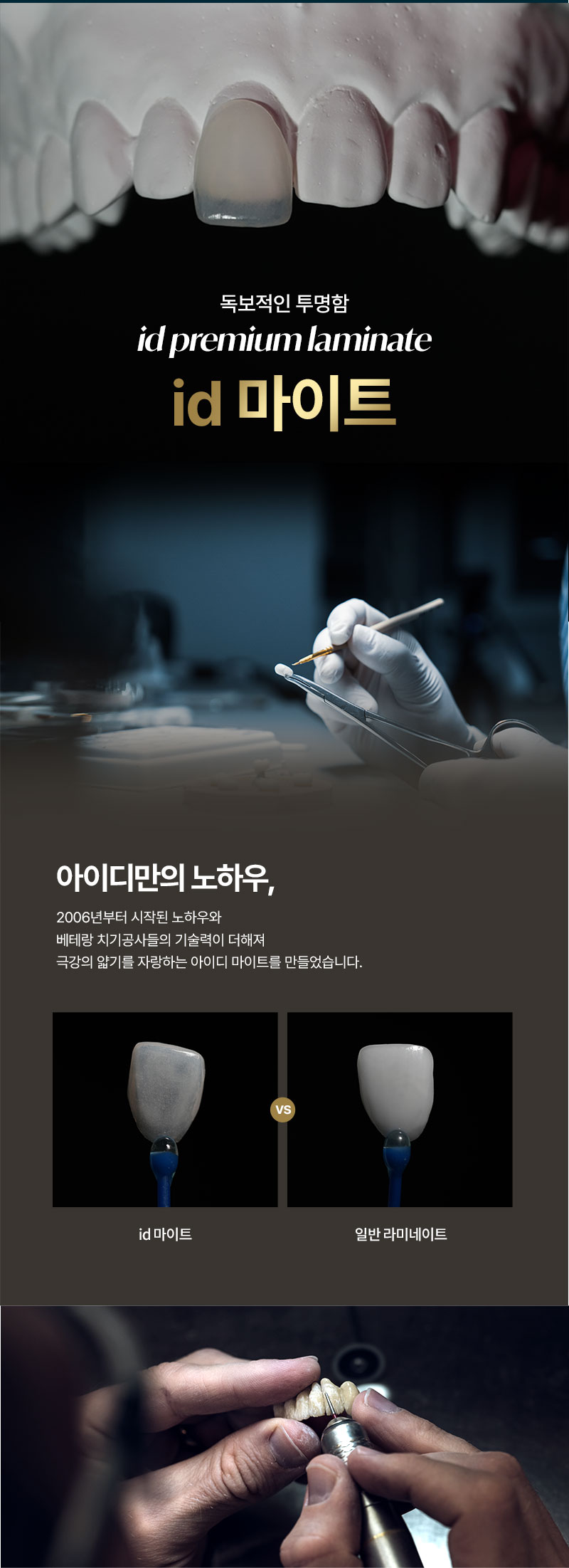 누런이, 토끼이, 벌어진 치아
걱정은 이제 그만! 
아이디 마이트 솔루션으로 
튼튼하고 자연스러운 라미네이트를 경험해보세요! 

독보적인 기술력으로 렌즈보다 
얇은 두께로 불필요한 치아 손상 없이 
아름다운 미소를 완성 할 수 있습니다. 