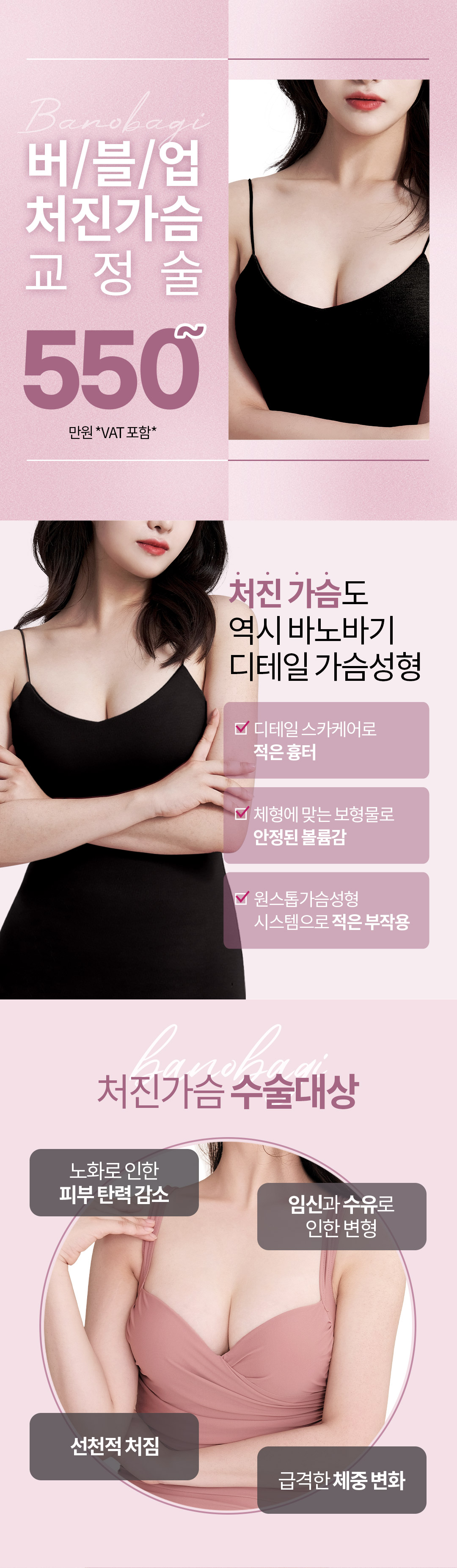 모유수유, 다이어트 등으로 처진 가슴도 역시 바노바기 디테일 가슴성형 