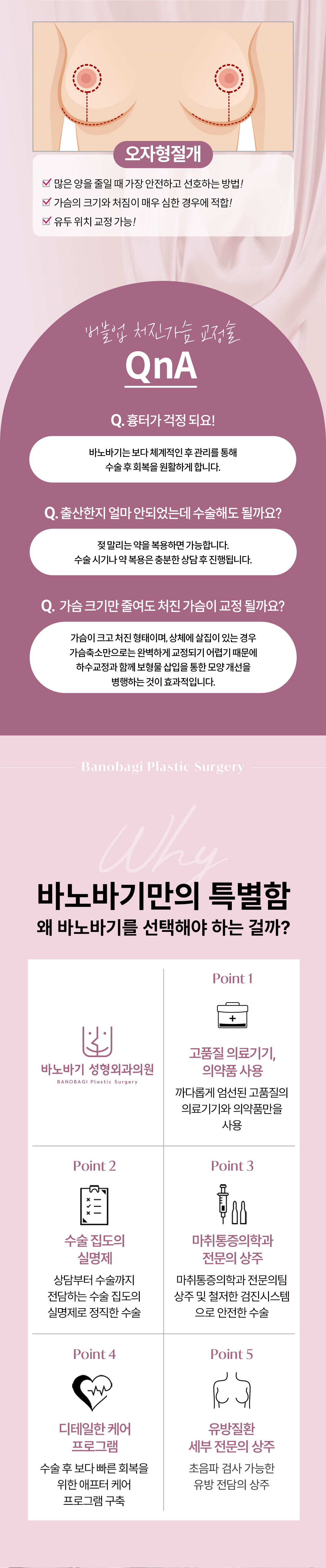 모유수유, 다이어트 등으로 처진 가슴도 역시 바노바기 디테일 가슴성형 