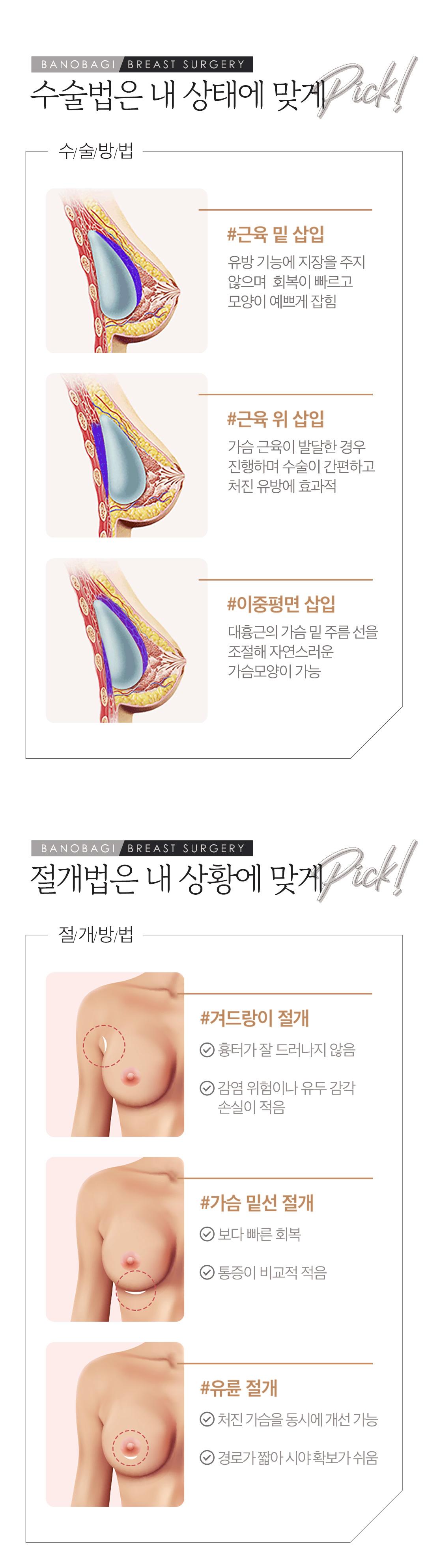 가슴 전문 여성 성형외과 전문의 개인 맞춤 수술. 여원장 집도 가슴성형.