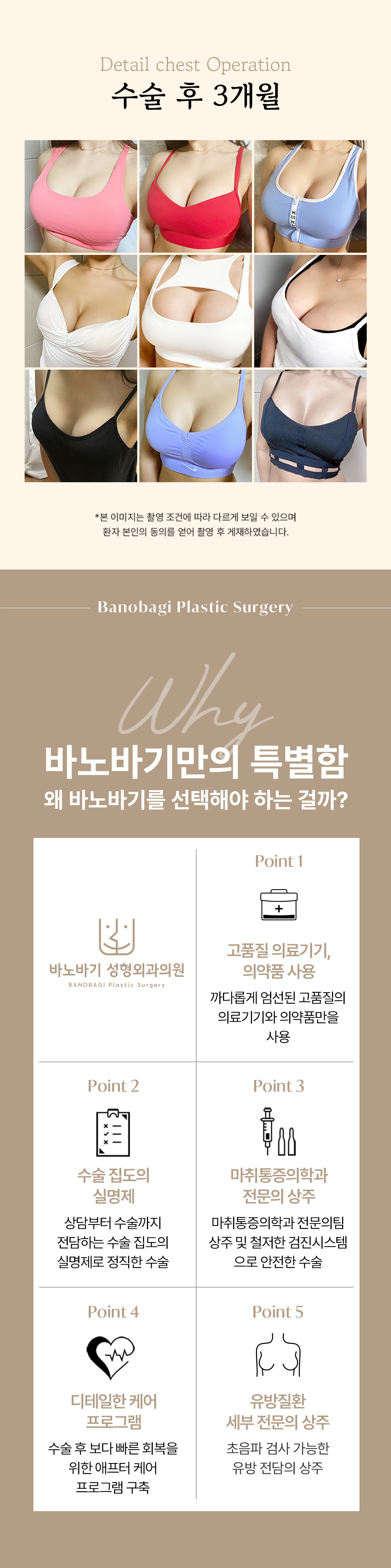 자연스러운 볼륨, 바노바기 세빈 서브리미티 가슴성형