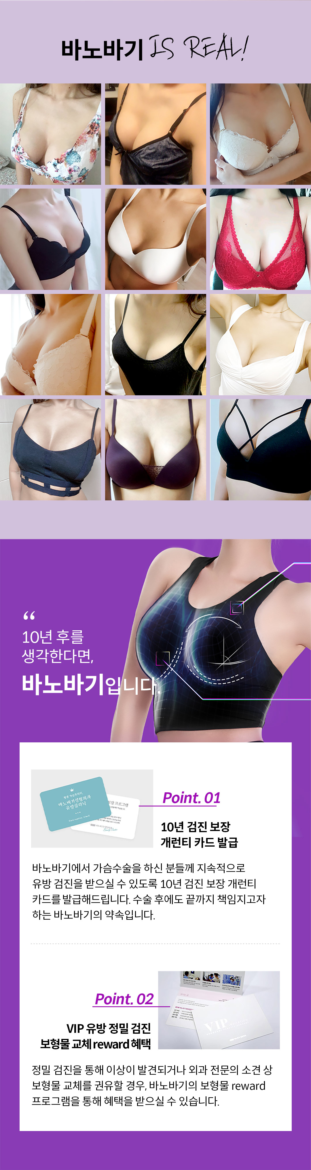 어떤 움직임에도 자연스럽게 디테일이 다른 볼륨으로, 바노바기 모티바 프리미엄 가슴성형