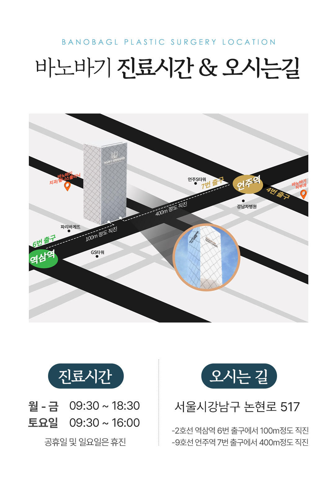 가슴수술은 안전하고 아름답게, 바노바기의 안전을 위한 까다로운 선택, 멘토 엑스트라 가슴성형