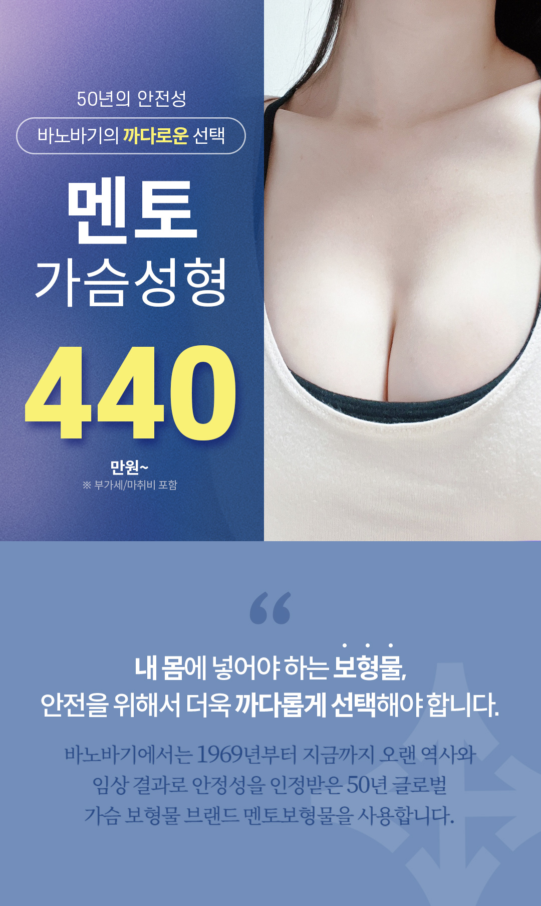 가슴수술은 안전하고 아름답게, 바노바기의 안전을 위한 까다로운 선택, 멘토 스무스 가슴성형
