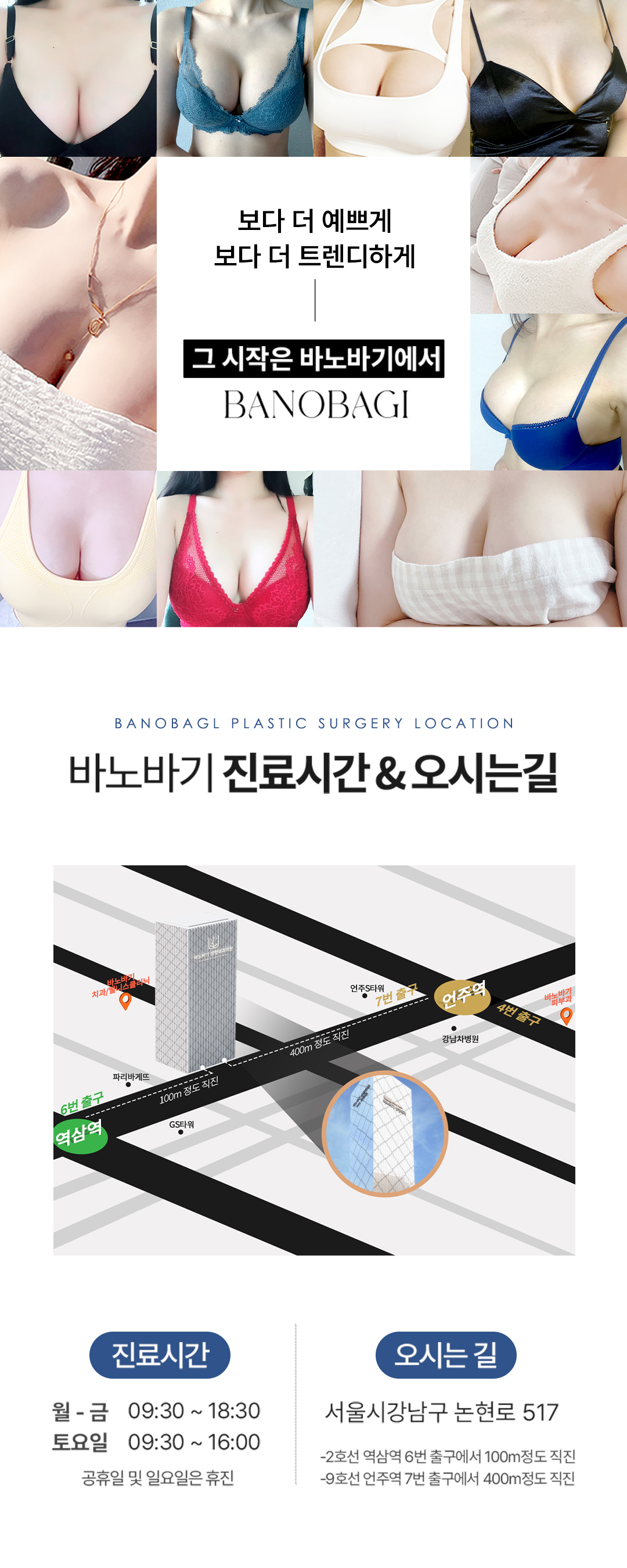 가슴수술은 안전하고 아름답게, 바노바기의 안전을 위한 까다로운 선택, 멘토 스무스 가슴성형