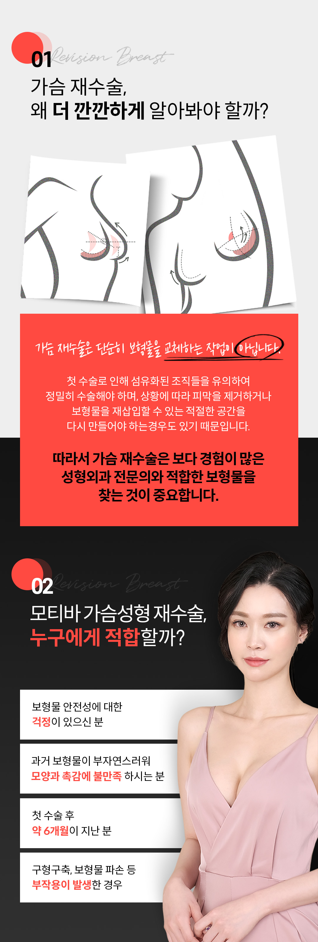 재수술이니까 더 신중하게 더 디테일하게, 바노바기 모티바 가슴 재수술