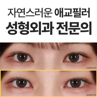 동안 눈매 애교필러_2주 이내 리터치