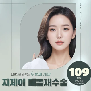 지제이 매몰 눈재수술