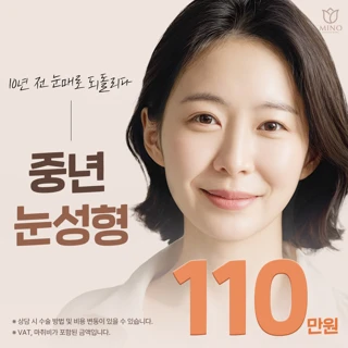 미노_중년눈성형