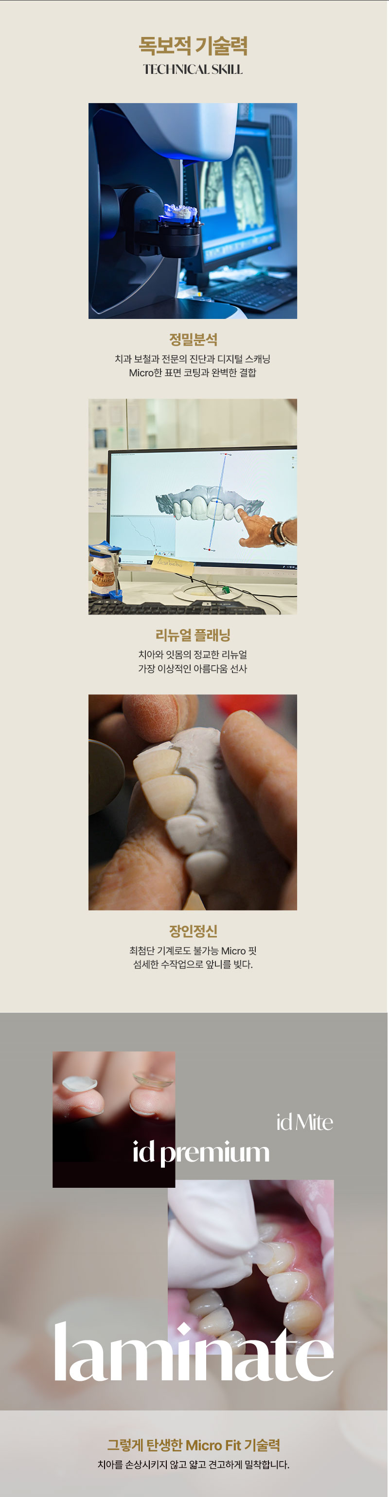 누런이, 토끼이, 벌어진 치아
걱정은 이제 그만! 
아이디 마이트 솔루션으로 
튼튼하고 자연스러운 라미네이트를 경험해보세요! 

독보적인 기술력으로 렌즈보다 
얇은 두께로 불필요한 치아 손상 없이 
아름다운 미소를 완성 할 수 있습니다. 