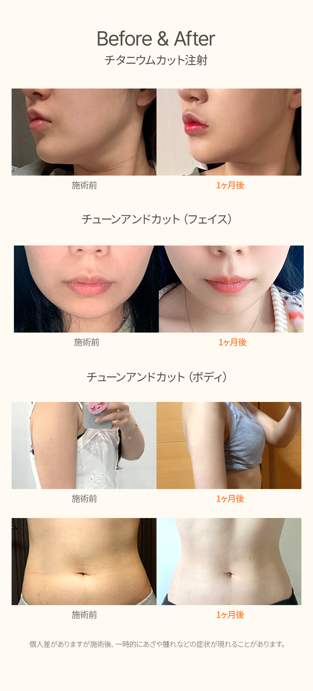 カット注射でDOWN チューンフェイスでリフトUP