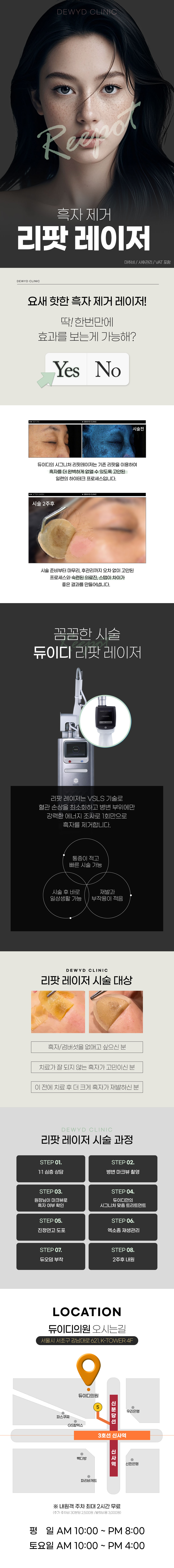 리팟 레이저는 Q-switch Nd:YAG 532nm 레이저 소스에 ‘VSLS 기술’이 적용된 기기로서 부작용을 최소화하고 단 1회로 흑자 제거를 가능케합니다.
마취비포함
사후관리(토닝1회,혈관레이저1회,기미주사1회,엑소좀+LDM1회)포함