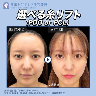 東京シンデレラ美容外科池袋院の口コミ・料金 | Unni（カンナムオンニ）