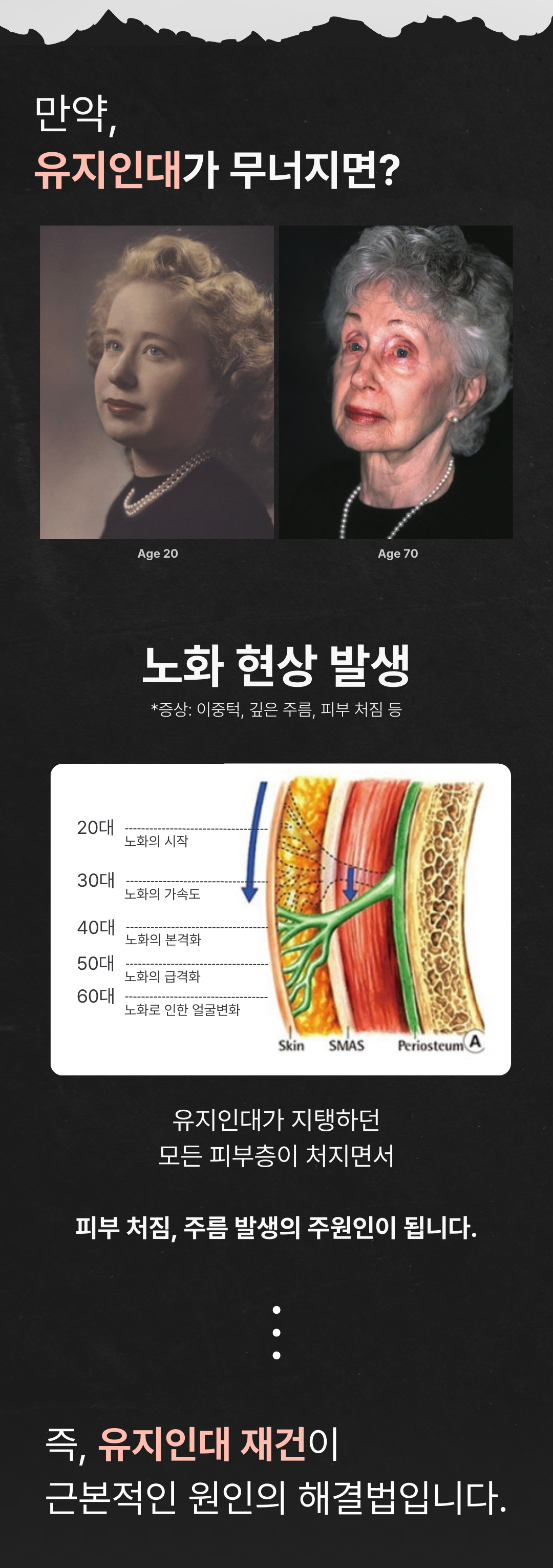 세계 최초
4가지 파장의 포트라 리프팅
포트라 리프팅?
포트라는 일정한 면적형태의 레이저 빔이 유지인대 부위에 열적 자극을 주어 새로운 콜라겐 생성을 유도하고 유지인대 조직이 다시 재생될 수 있도록 효과적으로 자극합니다.
유지인대?
얼굴의 생명나무라 불리며, 뼈의 골막부터 진피까지 피부탄력을 유지하도록 잡아주는 젊음 유지의 필수 조직입니다.
시술효과
1. 콜라겐 재생을 통한 리모델링
2. 즉각적인 리프팅 효과
3. 즉각적인 브라이트닝
4. 즉각적인 지방 수축
5. 피부 개선
6. 탄력 강화
효과 원리
1. 피부층별 에너지 매칭
- 755, 808, 940, 1064nm 피부층별로 에너지를 한 번에 전달
2. 에너지 전달 깊이 최대 10mm
- 유지인대 작용에 필요한 깊이까지 에너지 전달
3. 개인 피부 에너지값 맞춤 시술
- 에너지 강도와 전달 방식을 선택하여 개인 맞춤형 시술 가능
4. 시간당 토탈 에너지 증가
- 최적의 에너지를 빠르게 높여 리프팅 효과 극대화
5. 쿨링 시스템을 통해 피부 손상 없이 안전하게
오직 Project U 에서만?
Custom Lifting System으로 1:1 맞춤 시술이 진행됩니다
1. 3D 정밀 진단 - 피부 상세 분석
2. 고객 니즈 - 부위별 매칭값 점검
3. 의료진 1:1 맞춤 디자인 및 시술