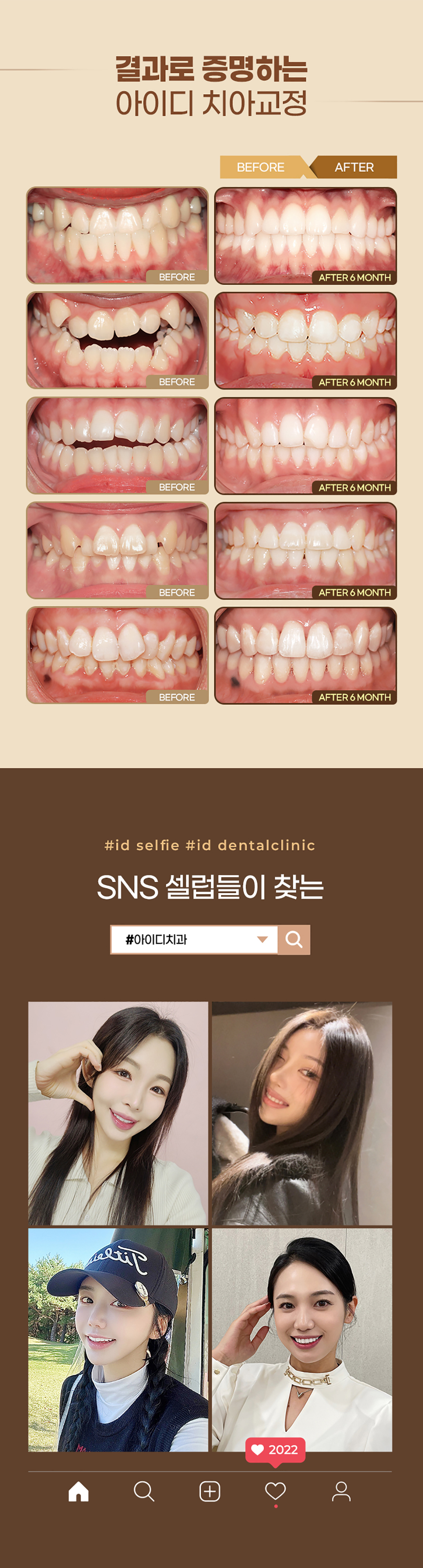 치아교정, 분납으로 비용부담 적게
부분교정으로 원하는 곳만 빠르게