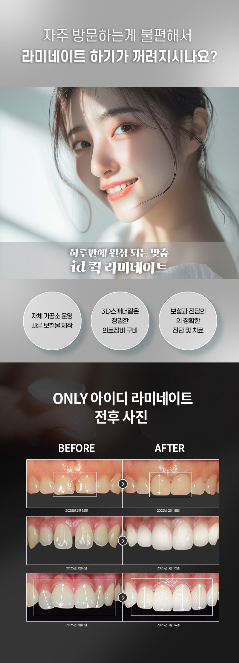 한번 방문으로 완성되는 아름다운 미소 
빠르게 시술하고 빠르게 일상으로 돌아갈 수 있습니다. 
누런 치아, 삐뚤어진 치아도 개선 가능 !

1:1 맞춤 디자인으로 높은 만족도
나에게  맞는 스타일을 골라보세요 !
- Trendy 한 연예인 스타일
- Manly 한 남자다운 스타일
- Lovely 한 귀여운 스타일

저희 치과는 자체 기공소를 보유하고 있어 
검증된 소재로 빠르게 보철물을 제작, 
안전한 시스템으로 최선의 효과를 경험할 수 있습니다. 