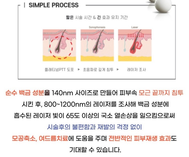 플래티넘 골드 PTT는 금과 백금 나노입자를 피부에 도포한 후, 특정 파장의 레이저를 조사하여 나노입자에 의해 열이 발생하도록 합니다. 이 열은 피지선에 직접 작용하여 과도한 피지 분비를 억제하고, 여드름 균을 파괴합니다. 이 치료법은 피지선에만 선택적으로 열 손상을 주기 때문에 주변 피부 조직에는 최소한의 손상을 주며, 이는 치료 후 회복 시간을 단축시키는 데 기여합니다.
피지선 축소를 통한 여드름 개선과 피부 재생, 콜라겐 층 치밀도 증가를 통한 탄력 개선에도 효과적입니다.