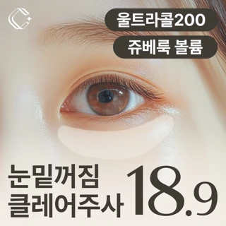 다크서클 눈밑꺼짐 클레어주사_쥬베룩볼륨 울트라콜200 자가혈줄기세포