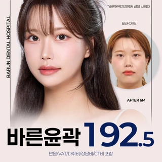 바른윤곽_안면윤곽1종 