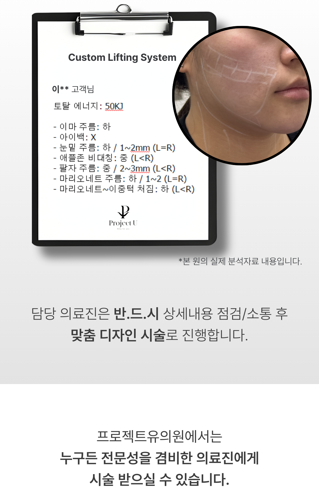 세계 최초
4가지 파장의 포트라 리프팅
포트라 리프팅?
포트라는 일정한 면적형태의 레이저 빔이 유지인대 부위에 열적 자극을 주어 새로운 콜라겐 생성을 유도하고 유지인대 조직이 다시 재생될 수 있도록 효과적으로 자극합니다.
유지인대?
얼굴의 생명나무라 불리며, 뼈의 골막부터 진피까지 피부탄력을 유지하도록 잡아주는 젊음 유지의 필수 조직입니다.
시술효과
1. 콜라겐 재생을 통한 리모델링
2. 즉각적인 리프팅 효과
3. 즉각적인 브라이트닝
4. 즉각적인 지방 수축
5. 피부 개선
6. 탄력 강화
효과 원리
1. 피부층별 에너지 매칭
- 755, 808, 940, 1064nm 피부층별로 에너지를 한 번에 전달
2. 에너지 전달 깊이 최대 10mm
- 유지인대 작용에 필요한 깊이까지 에너지 전달
3. 개인 피부 에너지값 맞춤 시술
- 에너지 강도와 전달 방식을 선택하여 개인 맞춤형 시술 가능
4. 시간당 토탈 에너지 증가
- 최적의 에너지를 빠르게 높여 리프팅 효과 극대화
5. 쿨링 시스템을 통해 피부 손상 없이 안전하게
오직 Project U 에서만?
Custom Lifting System으로 1:1 맞춤 시술이 진행됩니다
1. 3D 정밀 진단 - 피부 상세 분석
2. 고객 니즈 - 부위별 매칭값 점검
3. 의료진 1:1 맞춤 디자인 및 시술