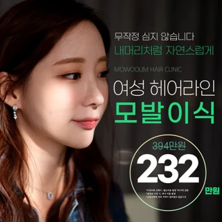 VIP 개인별 헤어라인 모발이식