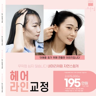 얼굴축소 여성 헤어라인 모발