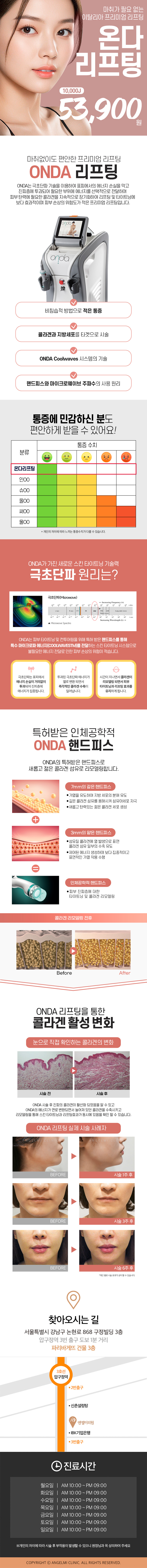 이탈리아 프리미엄 리프팅, 신개념 리프팅 등장