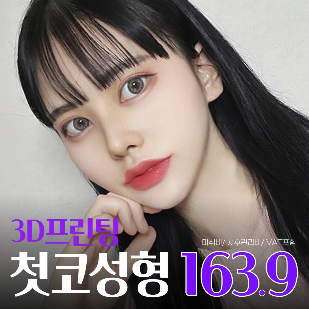 라라 대표원장_첫코성형