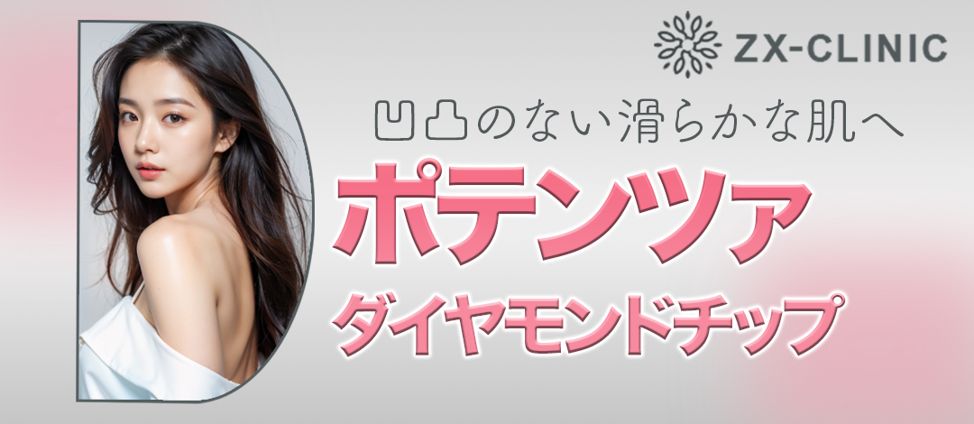 再来OK！！》ポテンツァ ダイヤモンドチップ（全顔300ショット