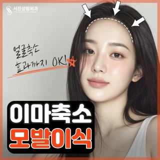 이마축소 헤어라인 모발이식