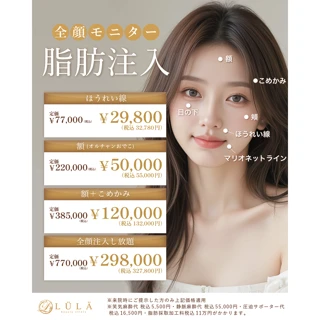 モニター|ほうれい線脂肪注入