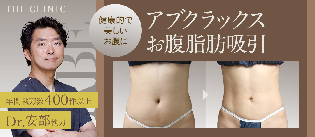 安部院長担当】アブクラックスお腹脂肪吸引モニター｜健康的で美しい