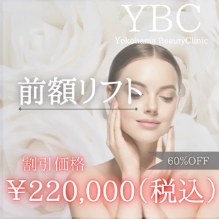 【モニター】前額リフト