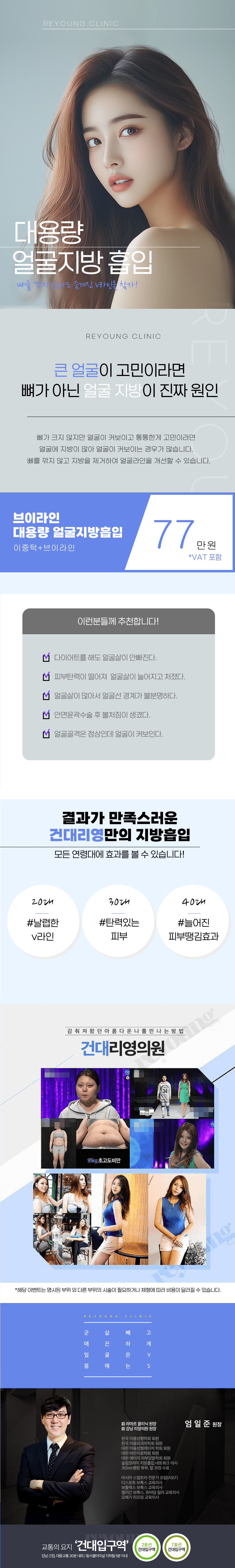 얼굴지방흡입도 턱라인 얼굴라인 처진얼굴을 브이라인으로 개선에 도움을 주는 지흡