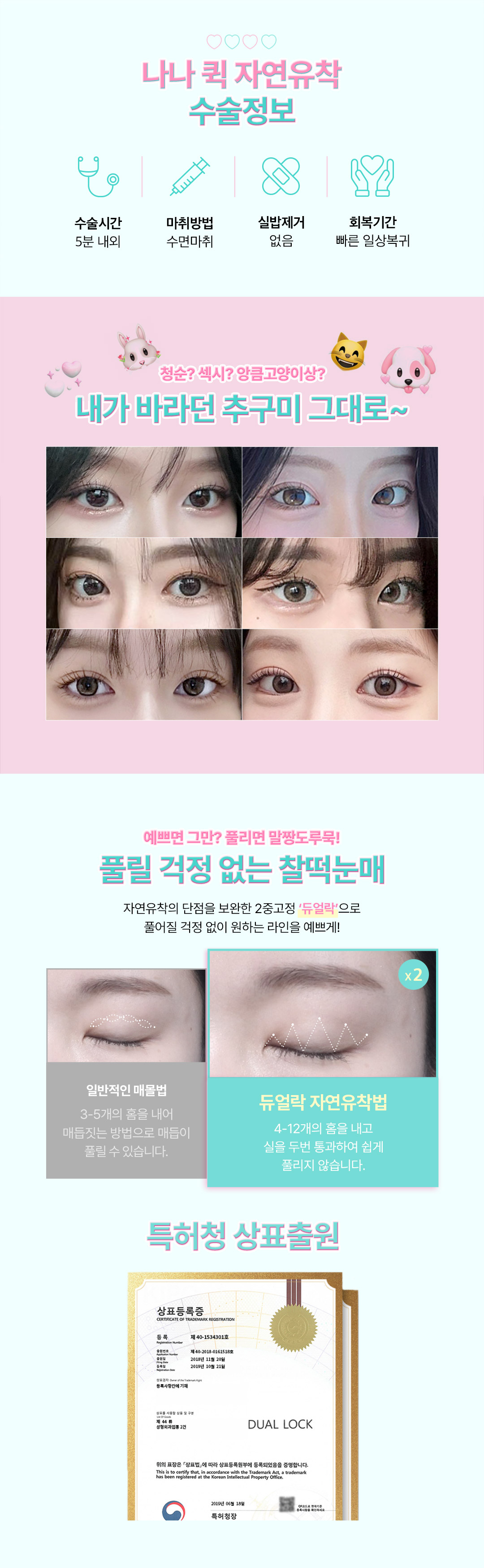 두번 묶어 풀릴 걱정없는 눈성형, 눈을 감아도 티 안나는 예쁜 세미아웃 라인