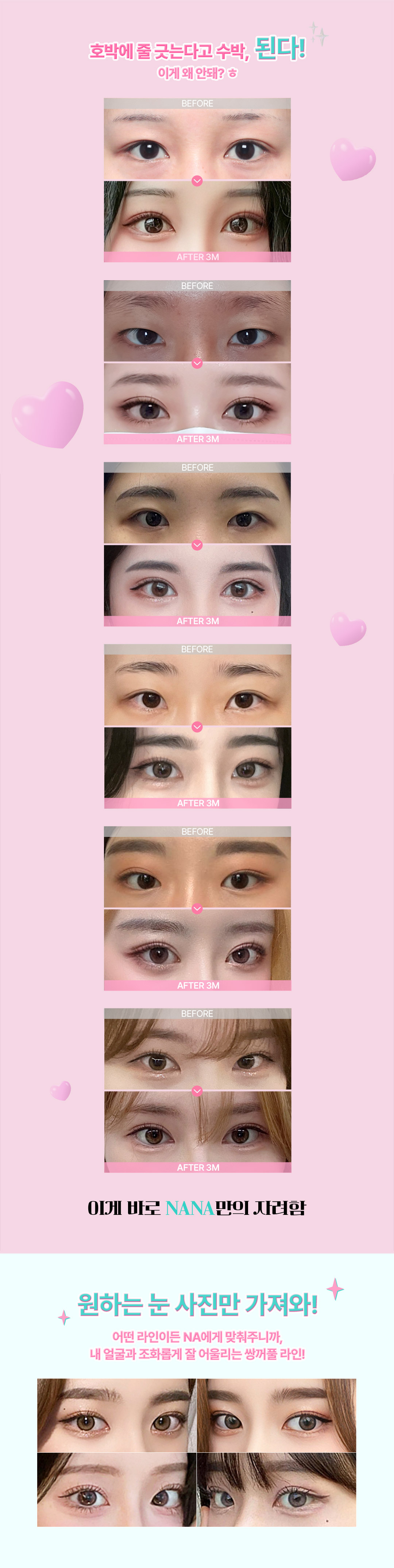 두번 묶어 풀릴 걱정없는 눈성형, 눈을 감아도 티 안나는 예쁜 세미아웃 라인