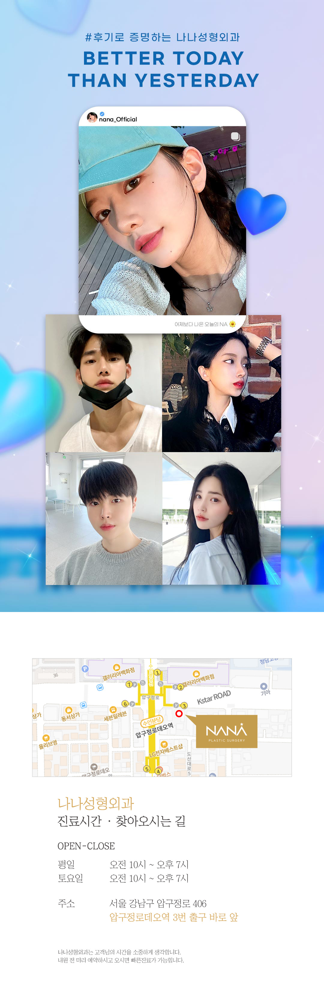 두번 묶어 풀릴 걱정없는 눈성형, 눈을 감아도 티 안나는 예쁜 세미아웃 라인