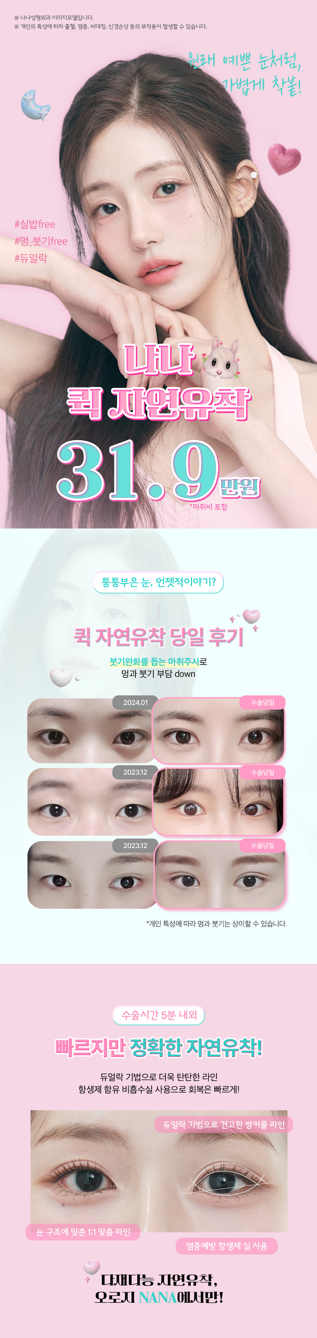 두번 묶어 풀릴 걱정없는 눈성형, 눈을 감아도 티 안나는 예쁜 세미아웃 라인