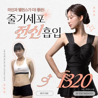 줄기세포 전신지방흡입