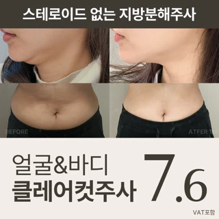 얼굴 바디 클레어컷주사